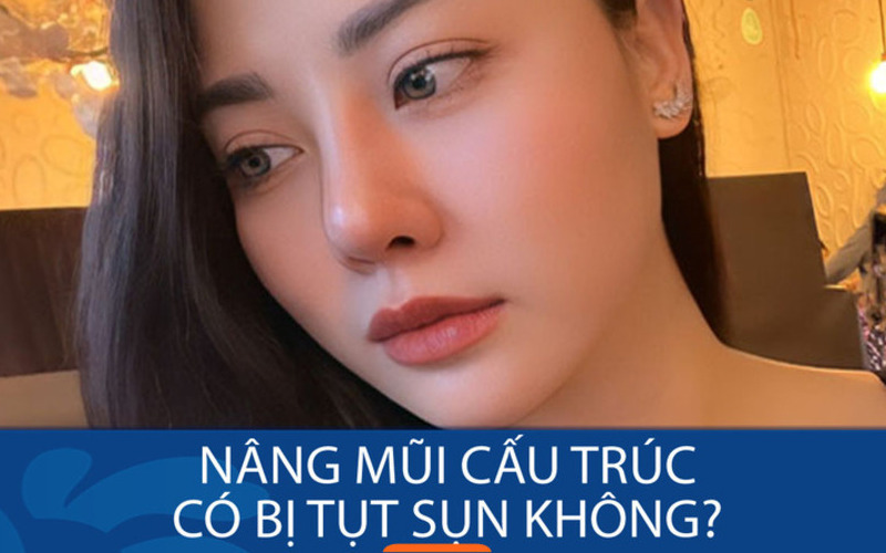 Nâng Mũi Cấu Trúc Có Bị Tụt Sụn Không? Sự Thật Cần Biết