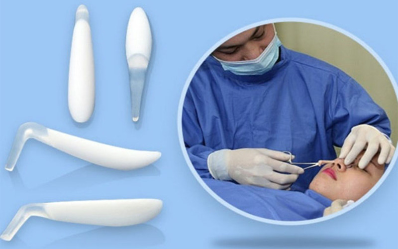 5 địa chỉ nâng mũi cấu trúc surgiform Hà Nội