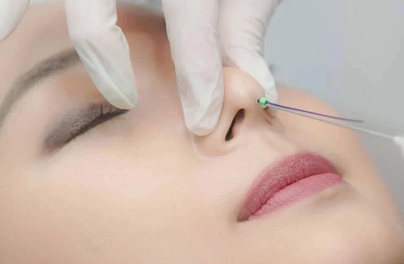 Thẩm mỹ MD Change Life - Nơi uy tín để bạn tin tưởng (Nguồn: Internet)