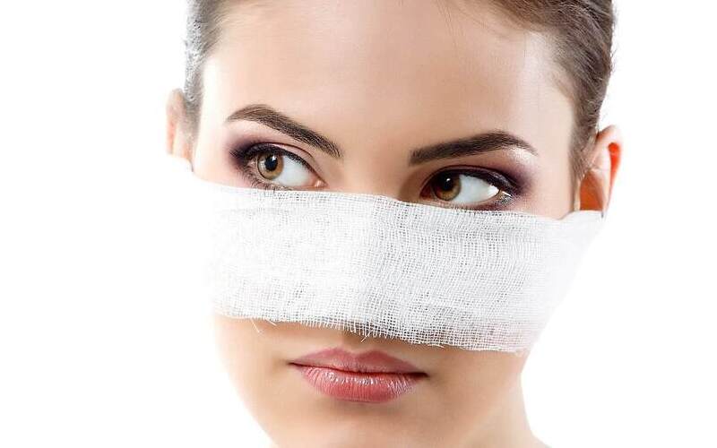 Nâng mũi chỉ collagen là gì?