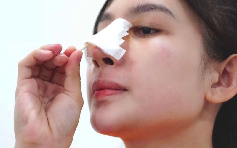 Nâng mũi có đau không? 3 mẹo giảm đau hiệu quả