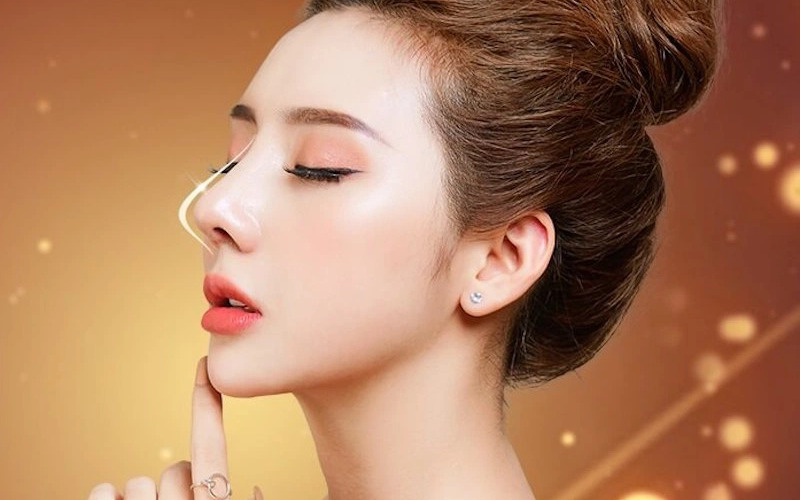 Nâng mũi đặt sống: Bí quyết sở hữu chiếc mũi đẹp