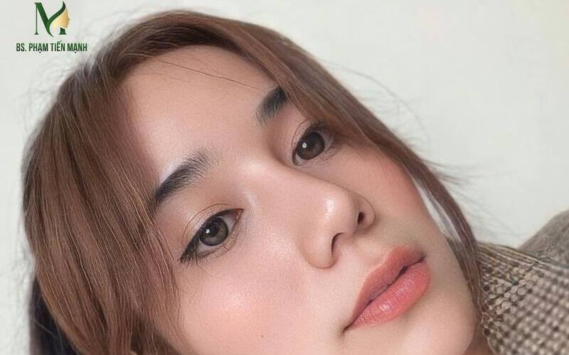 10 địa chỉ nâng mũi Hà Nội chất lượng