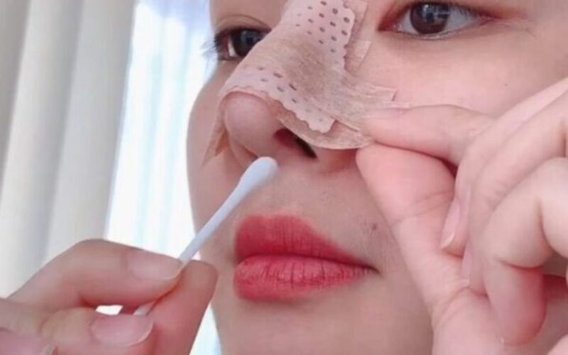 Chăm sóc hậu phẫu chưa đúng cách (Nguồn: Internet)