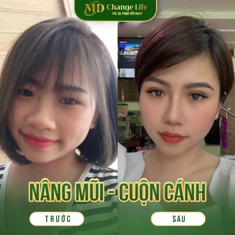 Đến với Thẩm mỹ MD Change Life để được trải nghiệm dịch vụ tốt nhất (Nguồn: Thẩm mỹ MD Change Life)