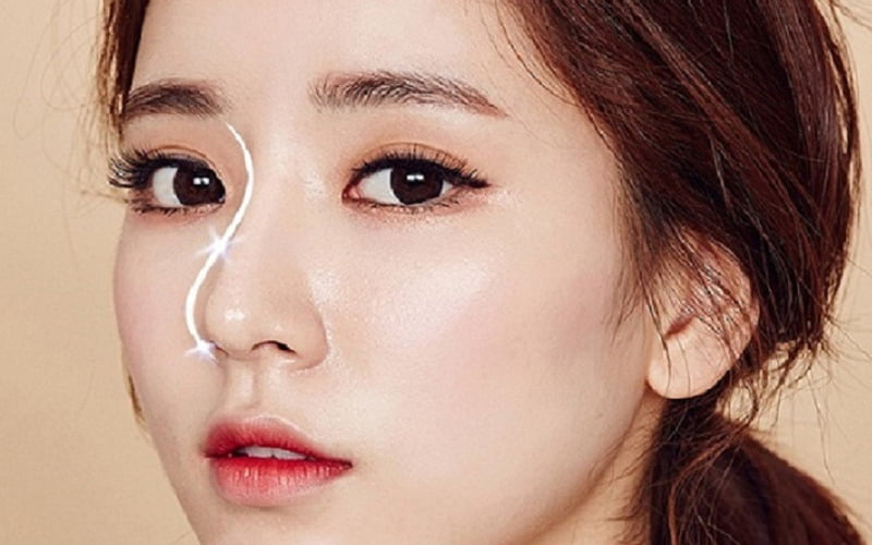 Nâng mũi S line (Nguồn: Internet)