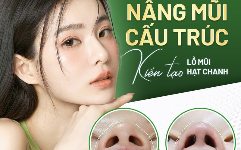 Nâng mũi cấu trúc tại MD Change Life (Nguồn: Internet)
