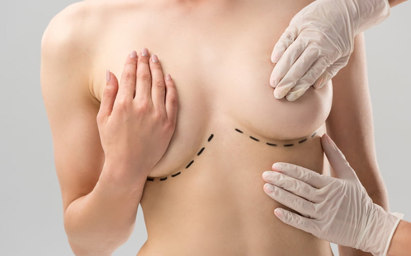 Nâng ngực bao lâu được nằm nghiêng để vòng 1 hoàn hảo sau phẫu thuật