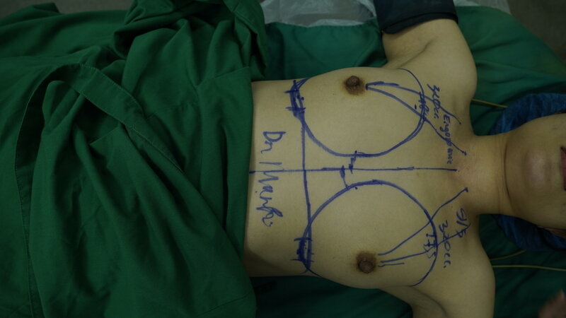 Thẩm mỹ MD Change Life - Địa điểm uy tín để bạn thực hiện phẫu thuật nâng ngực chuyển giới (Nguồn: MD Change Life) 