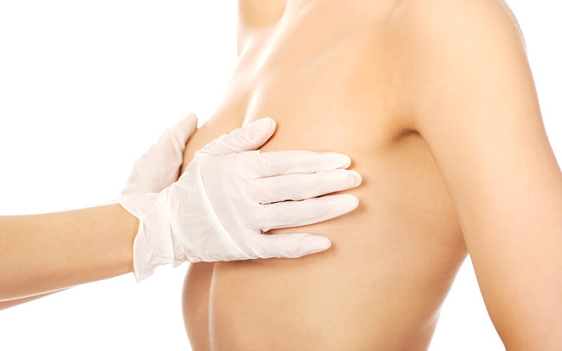 Ai nên và không nên nâng ngực? (Nguồn: Internet)