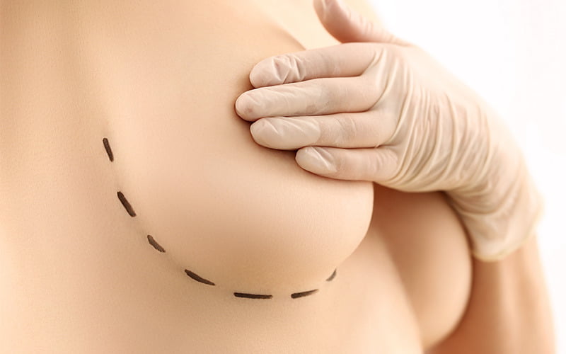 Hướng dẫn chăm sóc sau phẫu thuật đặt túi ngực (Nguồn: Internet)