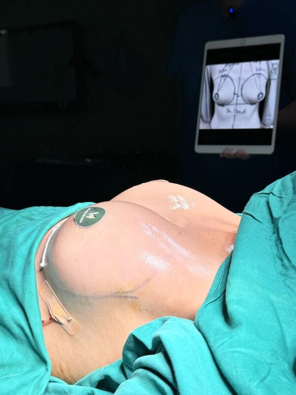 Nâng ngực an toàn, uy tín tại Thẩm Mỹ MD Change Life (Nguồn: Thẩm Mỹ MD Change Life)