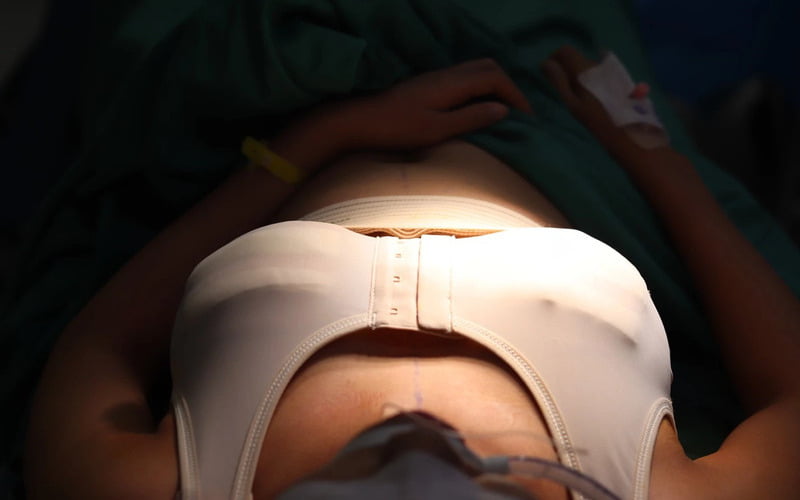 Có nhiều lý do khiến một người cần thực hiện nâng ngực sửa lại, bao gồm cải thiện kết quả thẩm mỹ, giảm thiểu các biến chứng và tăng cường sự tự tin (Nguồn: Internet)