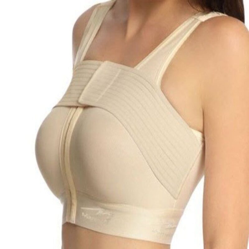 Bận áo định hình 24/24 (trừ khi đi tắm) khoảng 2 tuần đầu (Nguồn: Internet)