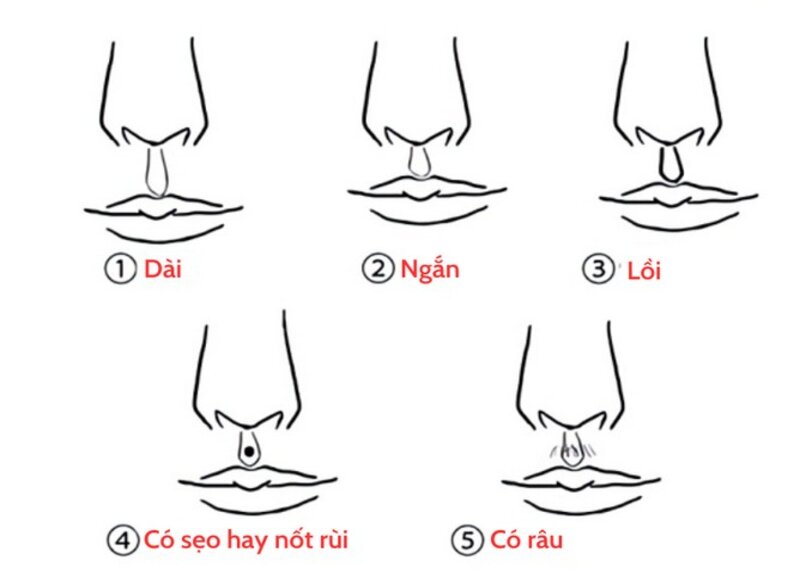 Ví dụ cho người có nhân trung dài (Nguồn: Internet)