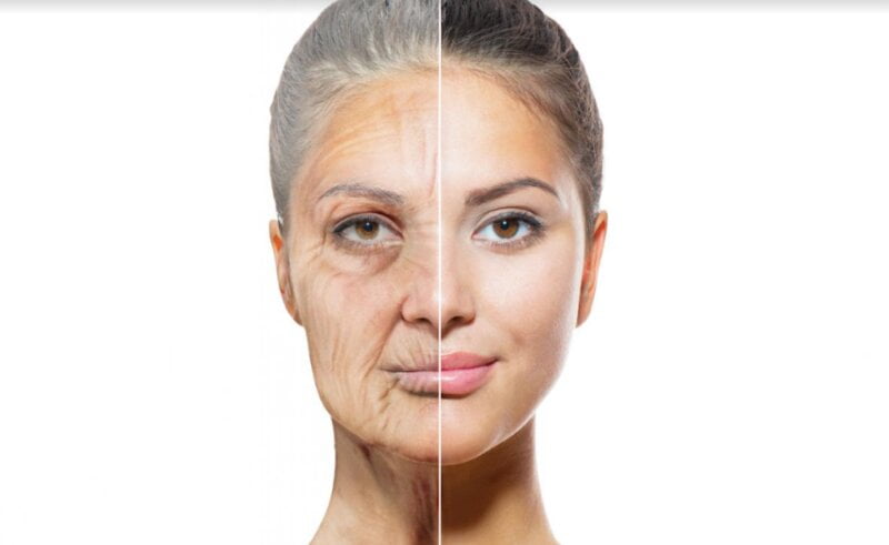 Biến là da có nếp nhăn trẻ hơn 10 tuổi (Nguồn: Internet)