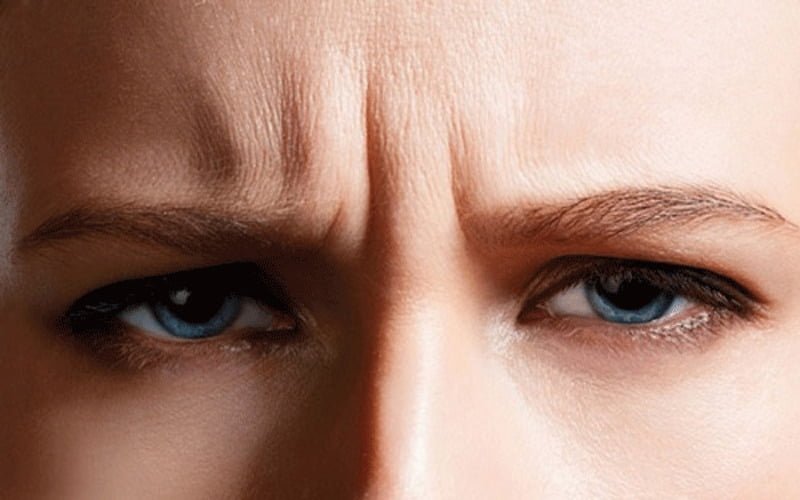 Nguyên nhân hình thành nếp nhăn gây cơ cau mày thường từ rất nhiều yếu tố cấu thành nên (Nguồn: Internet)