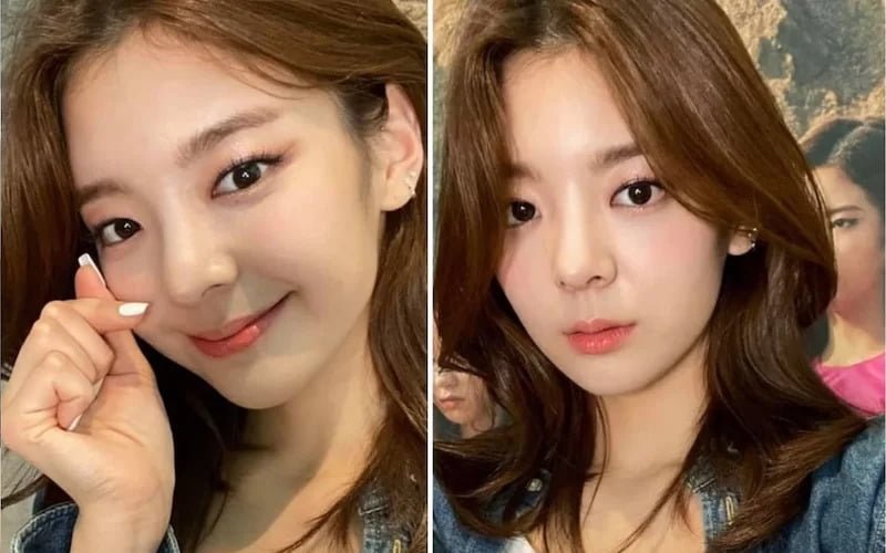 Tạo khóe môi cười (Nguồn: Internet)