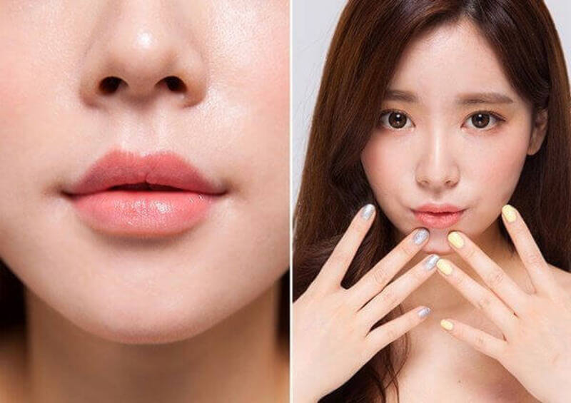 Ưu điểm vượt trội của phương pháp phẫu thuật tạo khóe môi cười (Nguồn: Internet)