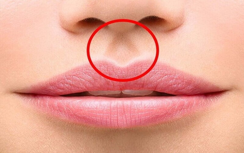 Phẫu thuật thu ngắn nhân trung mang lại nhiều ưu điểm, giúp bạn cải thiện thẩm mỹ và phục hồi sẹo nhanh chóng (Nguồn: Internet)