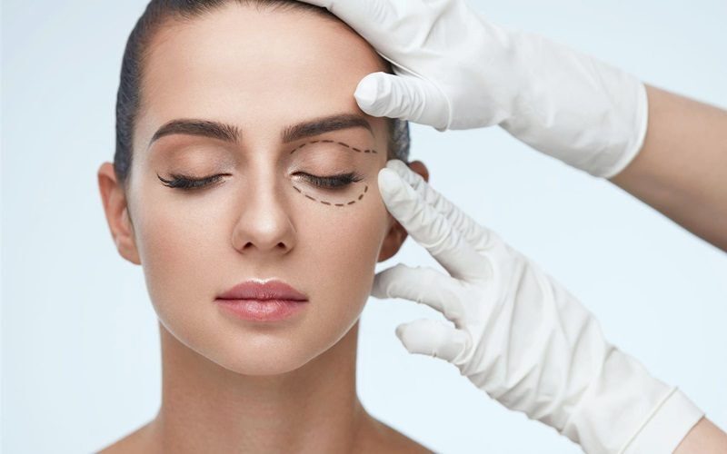 Review cắt mí dưới (Nguồn: Internet)