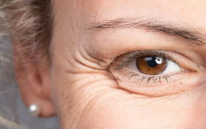 Da lão hoá tạo cảm giác mắt bị trợn (Nguồn: Internet)