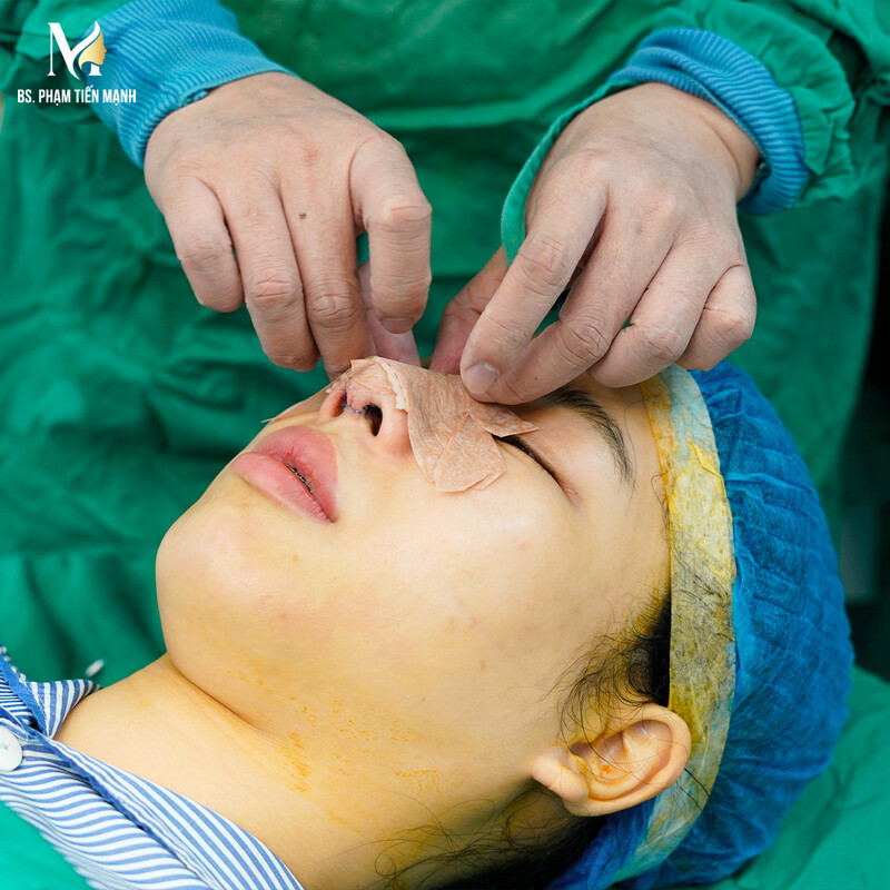 Chú ý chăm sóc mũi sau phẫu thuật (Nguồn: MD Change Life)
