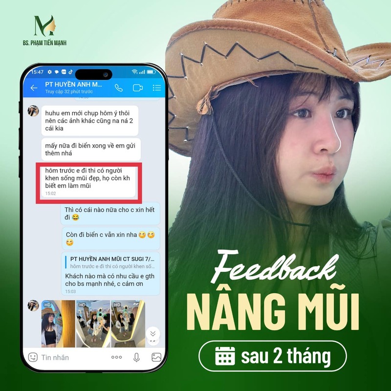 Feedback khách hàng sau nâng mũi tại MD Change Life (Nguồn: MD Change Life)