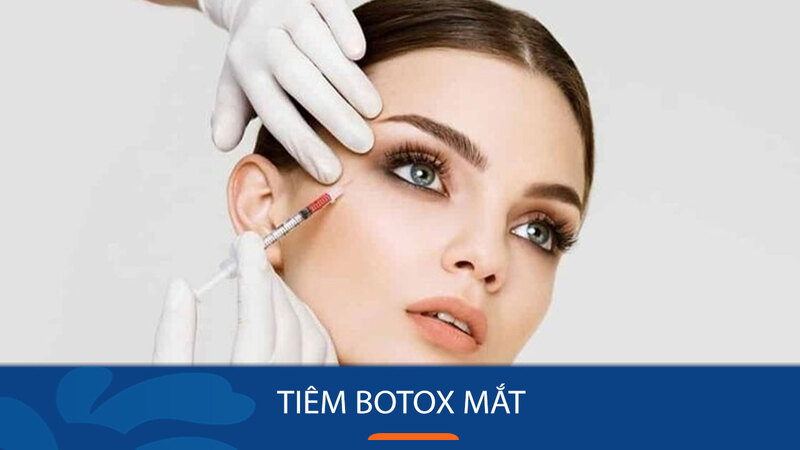 Tiêm botox để giảm sụp mí tạm thời ( Nguồn: Internet )