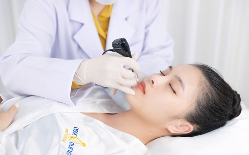 Tạo khoé môi cười Hà Nội tại Ngọc Dung (Nguồn: Internet)