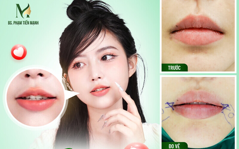 Top 5 địa chỉ tạo khóe môi cười tại Nghệ An