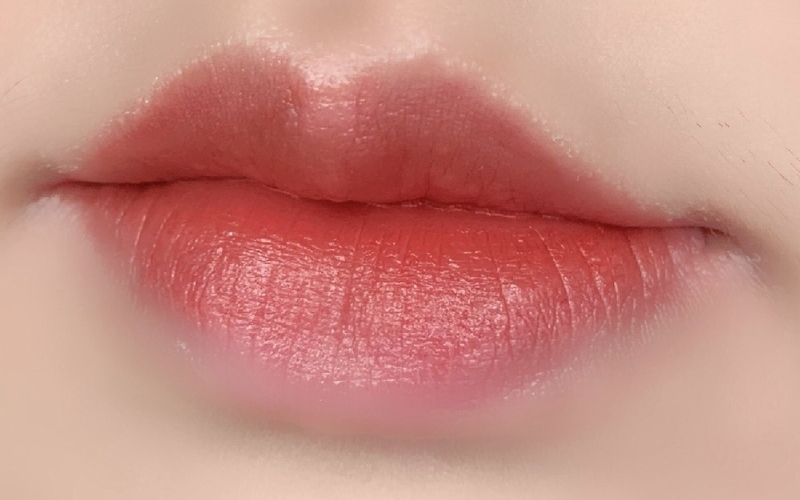 Top 5 địa chỉ tạo khóe môi cười tại Nghệ An