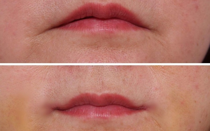 Top 5 địa chỉ tạo khóe môi cười tại Nghệ An