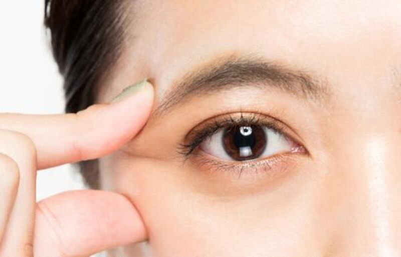 Tạo mắt 2 mí tại Thảo Ann Beauty & Spa (Nguồn: Internet)