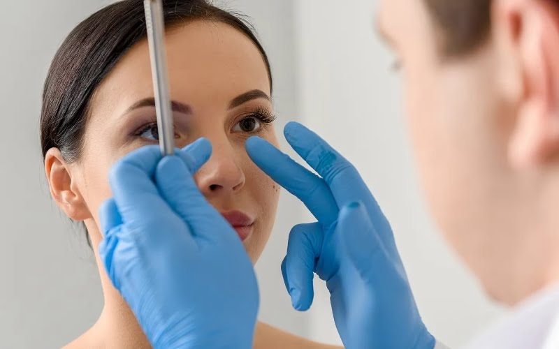 Trong một số trường hợp, tháo chất liệu mũi là biện pháp cần thiết để đảm bảo sức khỏe và thẩm mỹ cho khách hàng (Nguồn: Internet)