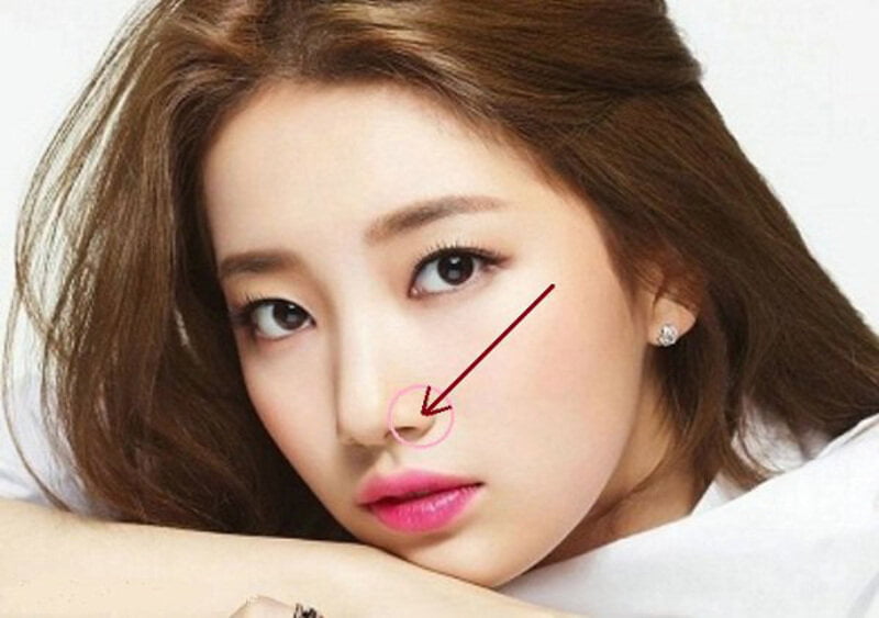 Thu gọn cánh mũi giúp bạn lấy lại nhan sắc (Nguồn: Internet)