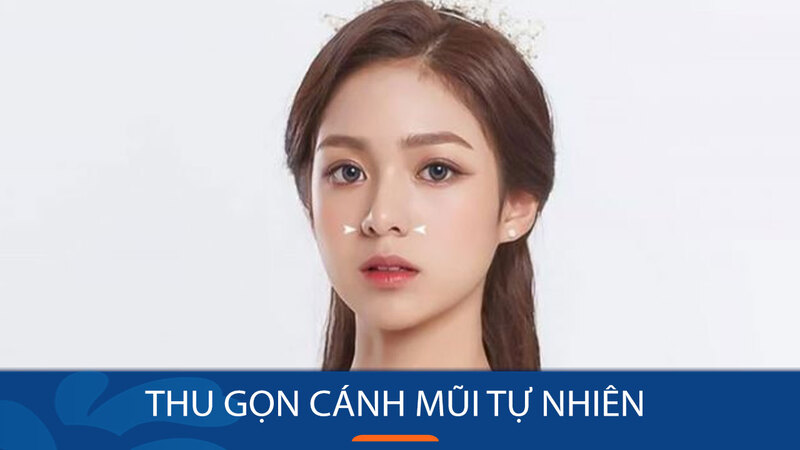 Cơ sở thu gọn cánh mũi Hà Nội: Kangnam (Nguồn: Internet)