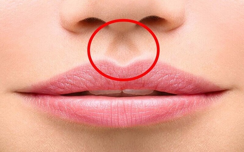 Thu ngắn nhân trung giá bao nhiêu? Bảng giá 2024