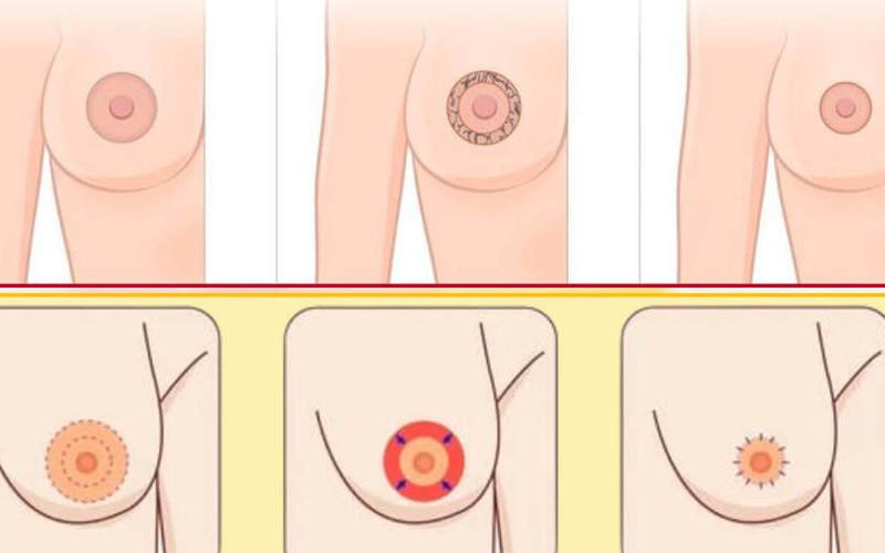 Hình ảnh mô phỏng quá trình thu quầng (Nguồn: Internet)
