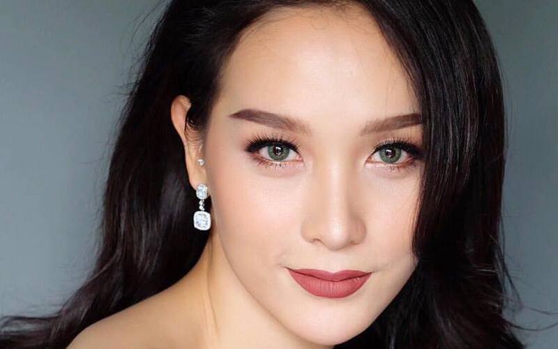 Mặt thon gọn sau tiêm botox góc hàm (Nguồn: Internet)