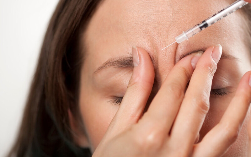 Tiêm cau mày (Nguồn: Internet)