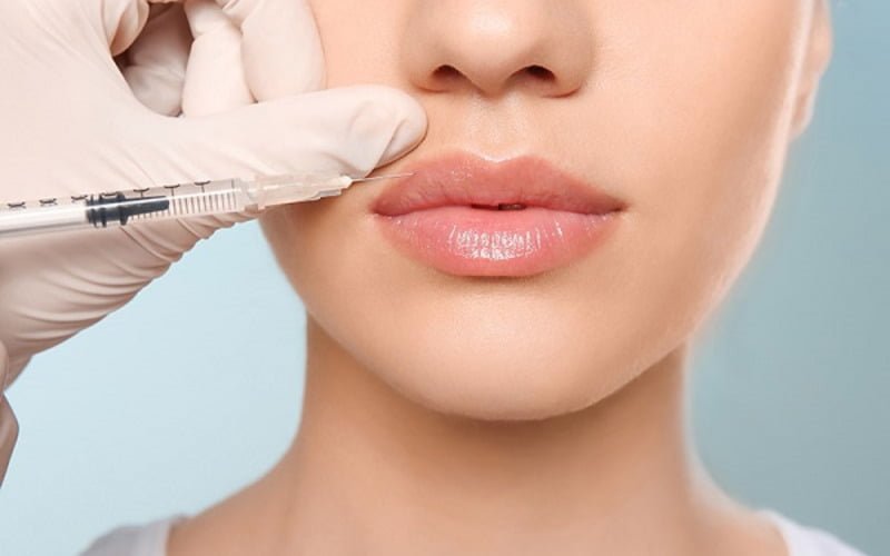 Tiêm filler môi mũi cằm đang dần trở thành "cơn sốt" trong lĩnh vực thẩm mỹ bởi những ưu điểm vượt trội (Nguồn: Internet)
