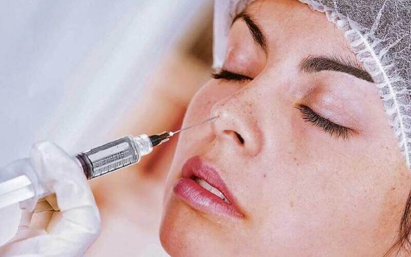 Xử lý tiêm filler mũi bị hoại tử (Nguồn: Internet)