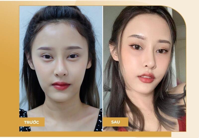 Thẩm mỹ MD Change Life - Nơi uy tín cho chị em tin tưởng (Nguồn: Internet)