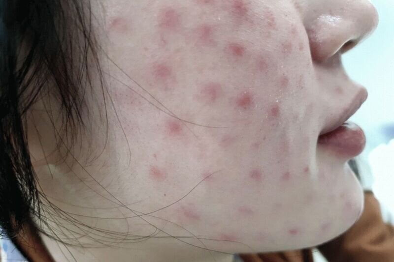 Không thể tránh khỏi rủi ro (Nguồn: Internet)