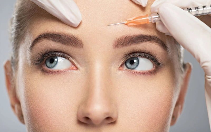 Tiêm xóa nếp nhăn là phương pháp thẩm mỹ sử dụng Botox tiêm vào cơ trán để làm giảm co cơ, từ đó xóa mờ nếp nhăn và ngăn ngừa lão hóa (Nguồn: Internet)
