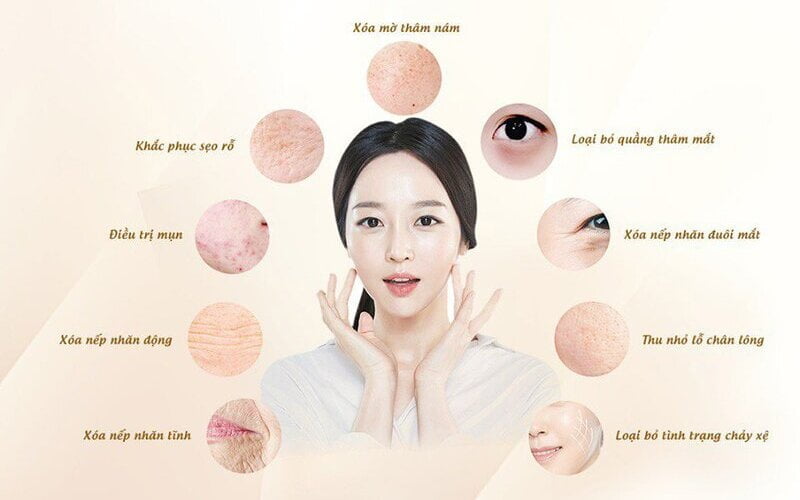 PRP trẻ hóa da (Nguồn: Internet)