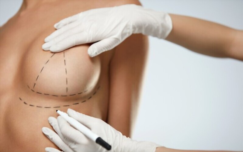 Tại sao nên chọn nâng ngực tại MD Change Life? (Nguồn: Internet)