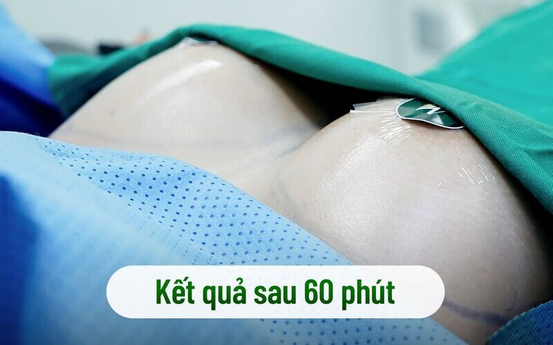 Ngực căng tròn, quyến rũ (Nguồn: MD Change Life)