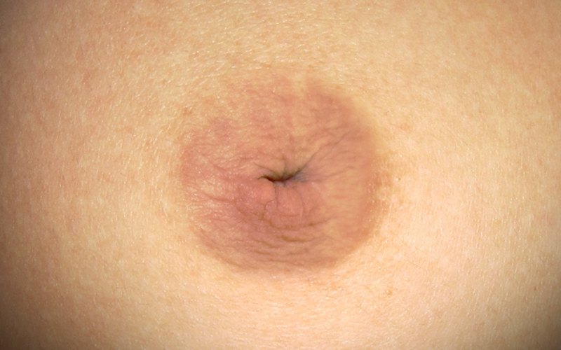 Tụt núm vú: Nguyên nhân và 3 cách khắc phục hiệu quả